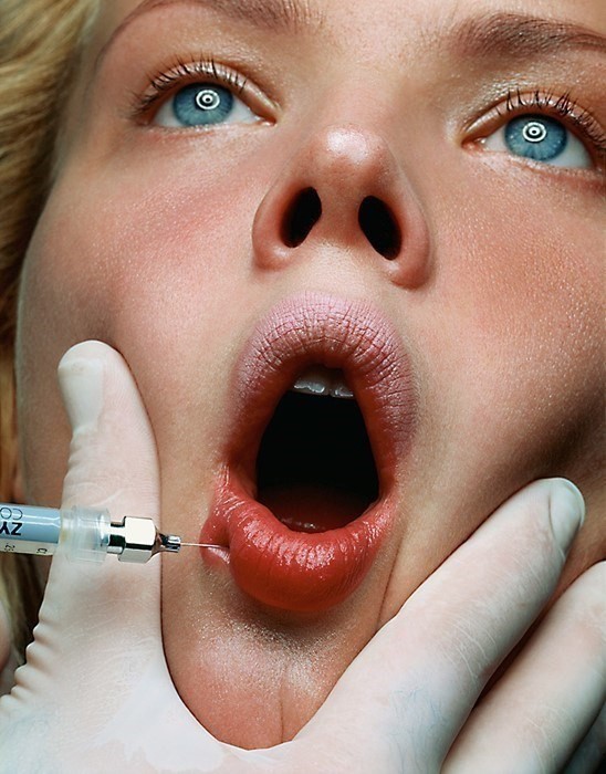 Botox and filler