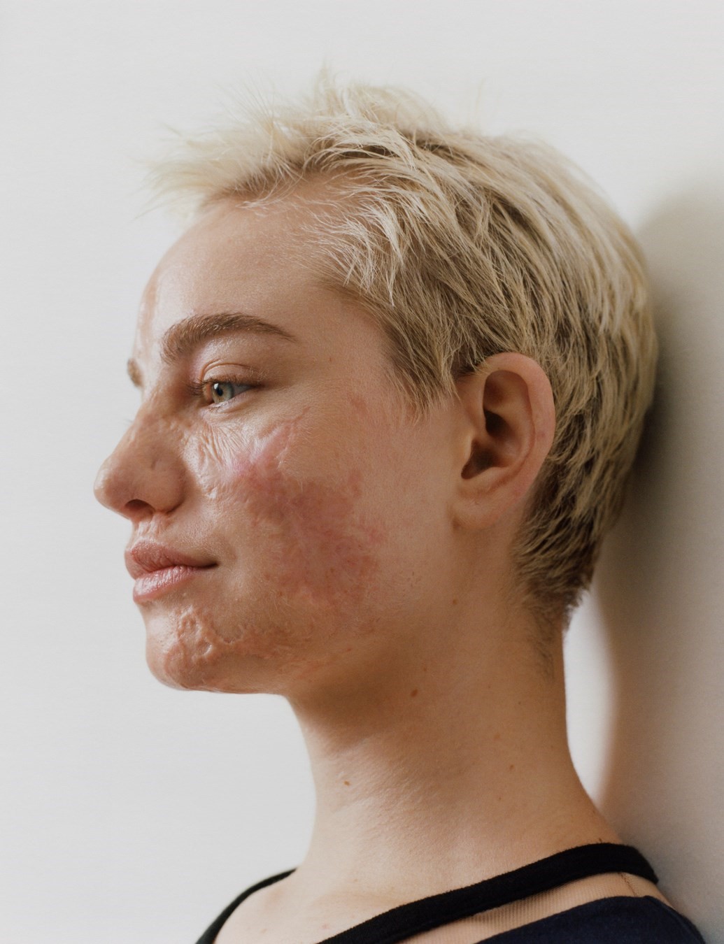 Bebe Vio, Dazed Summer 2024