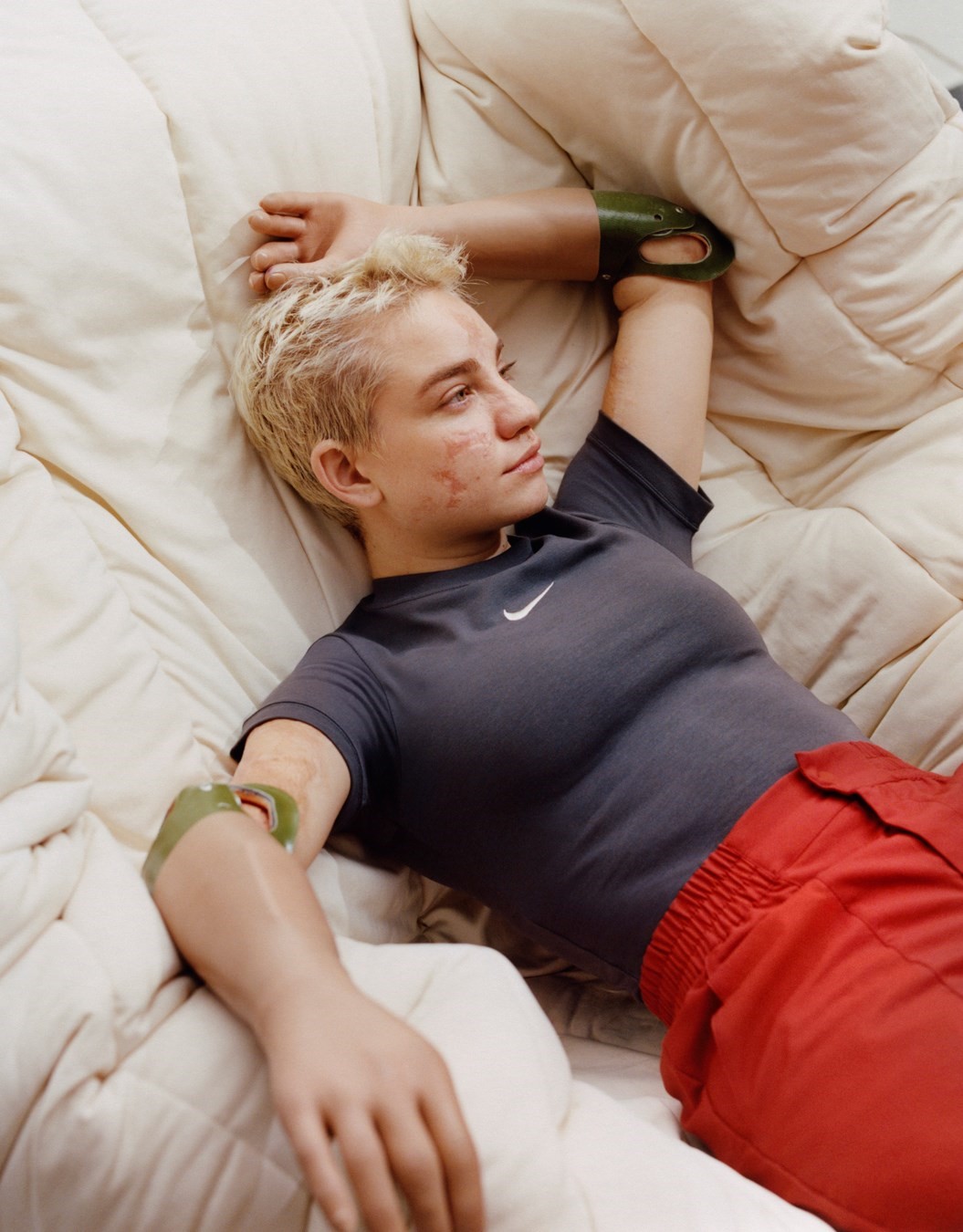 Bebe Vio, Dazed Summer 2024