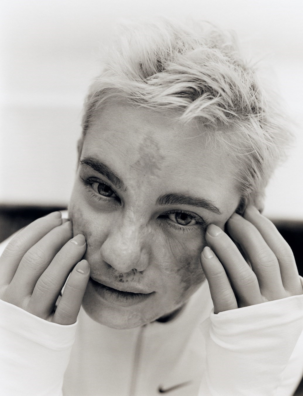 Bebe Vio, Dazed Summer 2024