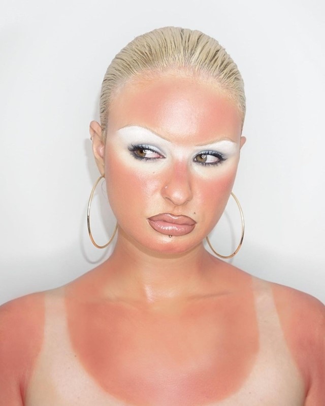 Sunburn aesthetic tan lines